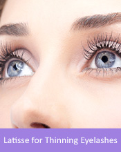 Latisse for Thinning Eyelashes