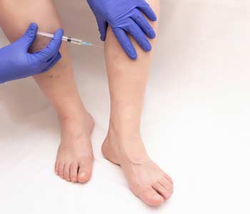 The Benefits of Sclerotherapy in Chagrin Falls area